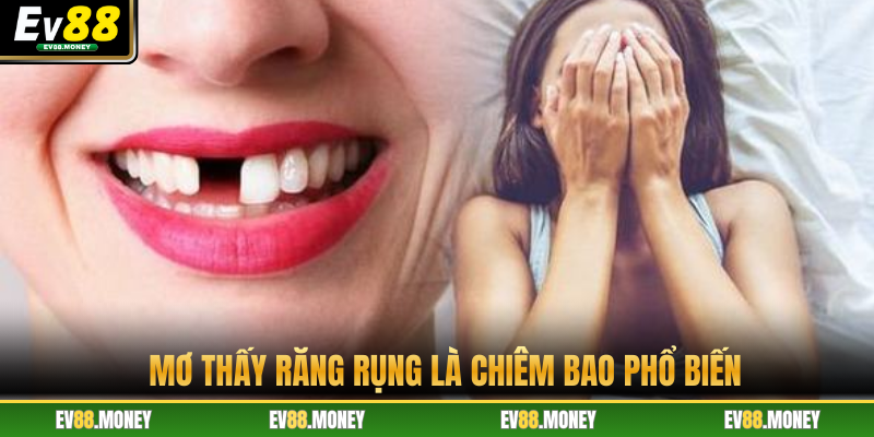 Mơ thấy răng rụng là chiêm bao phổ biến